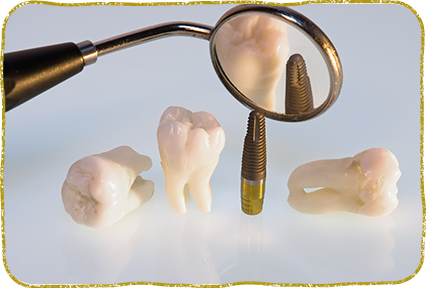 日立市・田所歯科医院・インプラントとは