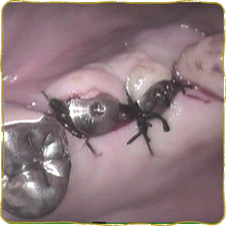 日立市・田所歯科医院・症例写真