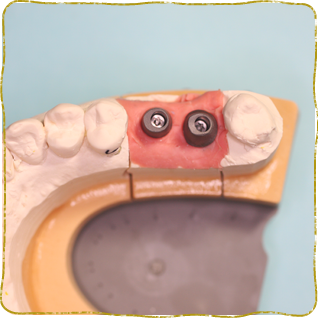 日立市・田所歯科医院・症例写真