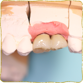 日立市・田所歯科医院・症例写真