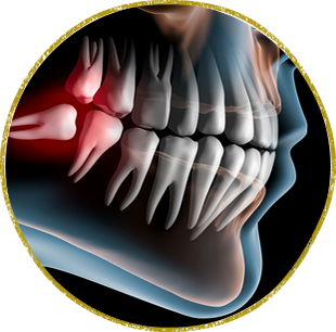 日立市・田所歯科医院・歯科口腔外科（親知らず・顎関節症・歯ぎしり・食いしばり）