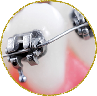 日立市・田所歯科医院・矯正歯科